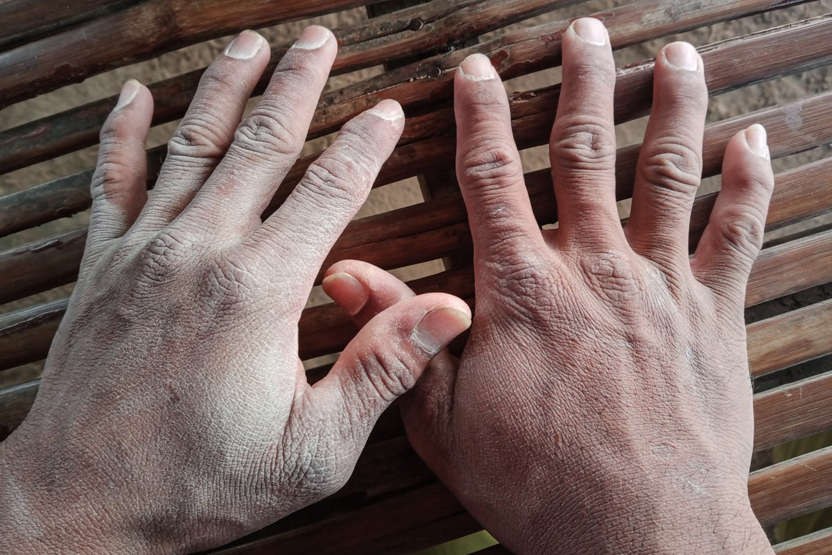 A close-up photo of a man’s hands covered in white-coloured powder. 